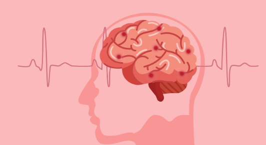 Stroke Prediction project